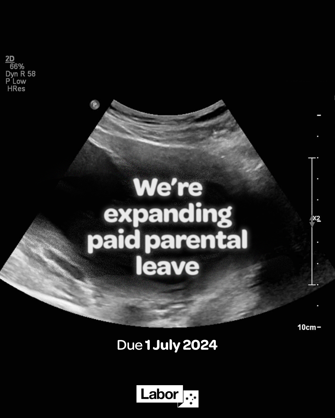 Delivering a historic expansion of Paid Parental Leave Main Image